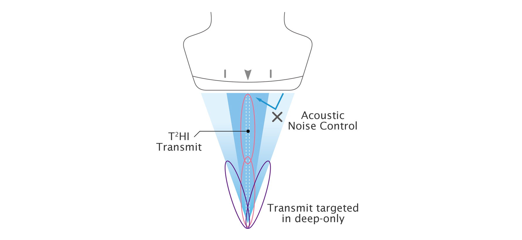 img_product_ultrasound_002