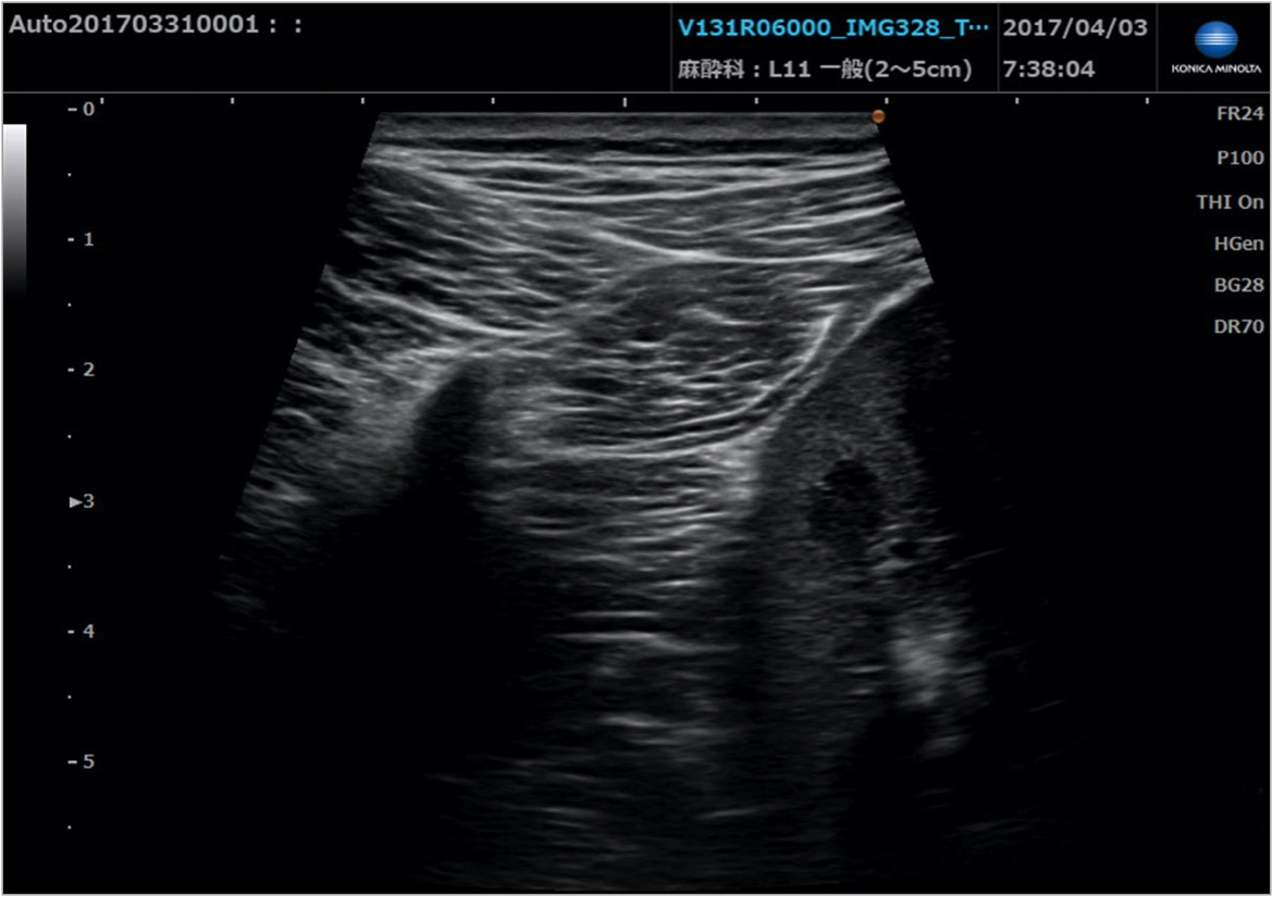 img_product_ultrasound_006