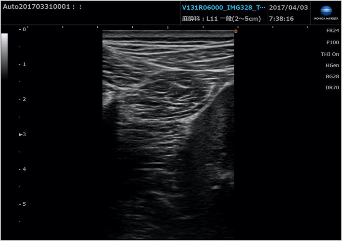 img_product_ultrasound_007