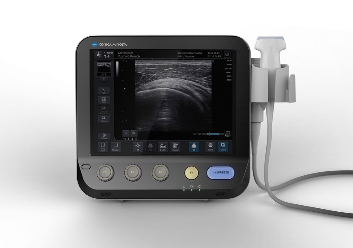 img_ultrasound_mx_1_top_002
